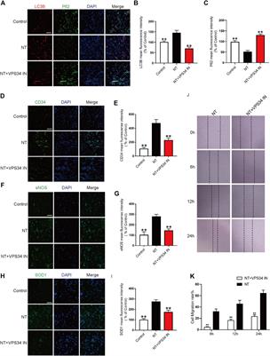 Notoginseng Triterpenes Inhibited Autophagy in Random Flaps via the Beclin-1/VPS34/LC3 Signaling Pathway to Improve Tissue Survival